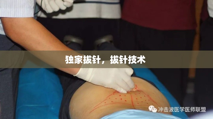 独家拔针,拔针技术